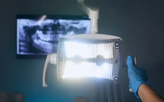 Cyfrowe zdjęcie rentgenowskie zębów na ekranie i lampa zabiegowa w ciemnym gabinecie